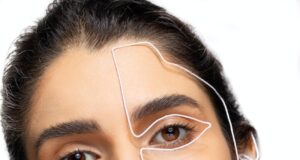 Nová Metoda Omlazení: Deep Plane Facelift