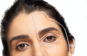 Nová Metoda Omlazení: Deep Plane Facelift